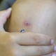 Illustration for article titled Tiny sea snail grows and hatches inside little boys knee